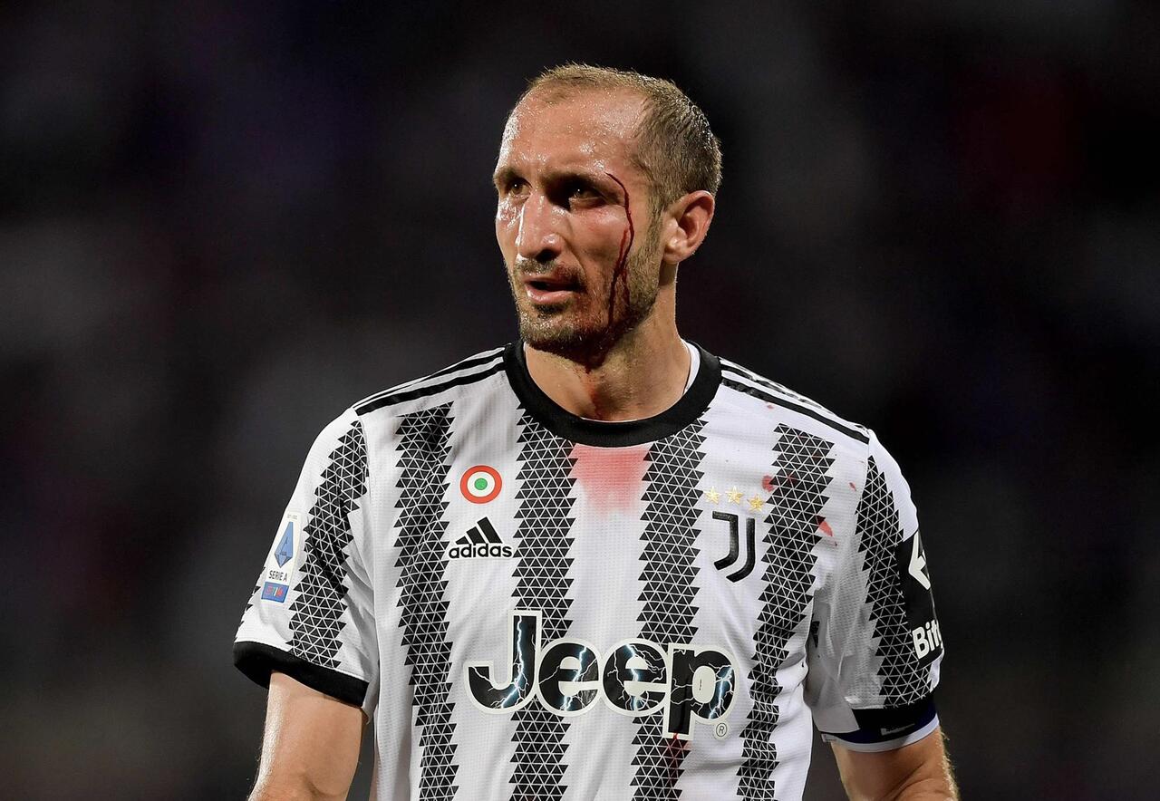 Chiellini